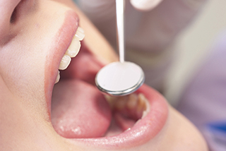 歯周病と体の健康状態との相関関係