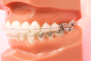 赤羽歯科「東大宮診療所」の矯正治療の特徴